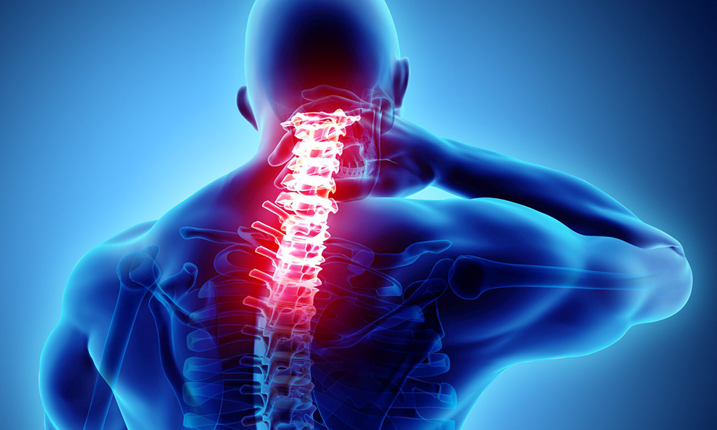 Arthritis of the Spine Treatment Miami