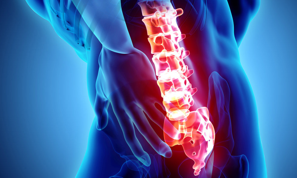 Spinal Stenosis Treatment Miami