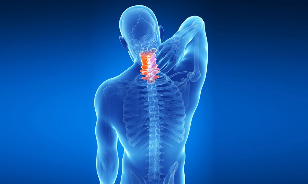 Cervical Spondylosis Treatment Miami