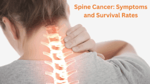 Spine Cancer: Symptoms and Survival Rates Spine Cancer: Symptoms and Survival Rates
