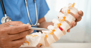 Cost of Cervical Disc Replacement​ in USA