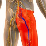 Sciatica in 2025: What’s New in Diagnosis and Treatment?