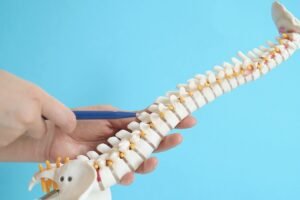 Managing Adult Degenerative Scoliosis