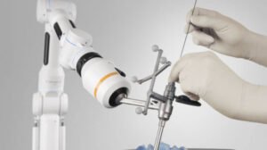 Robotic-Assisted Motion Preservation Surgery: Precision Alignment for Complex Spinal Stenosis
