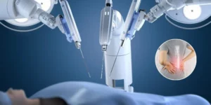 Robotic-Assisted Minimally Invasive Spine Surgery (MISS): Sub-Millimeter Instrumentation and Faster Postoperative Mobilization